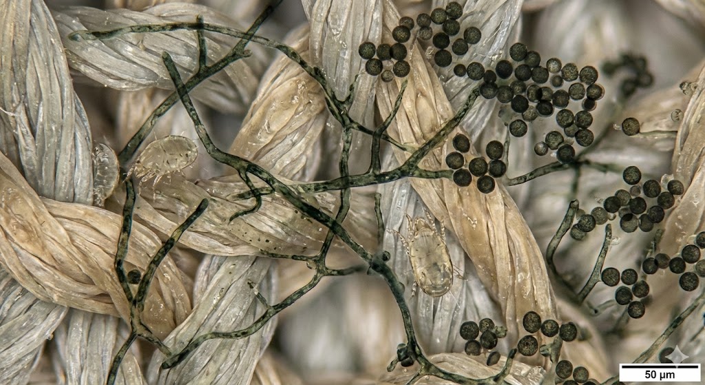 เชื้อราบนเสื้อผ้าและไรฝุ่นที่เป็นสาเหตุของโรคภูมิแพ้